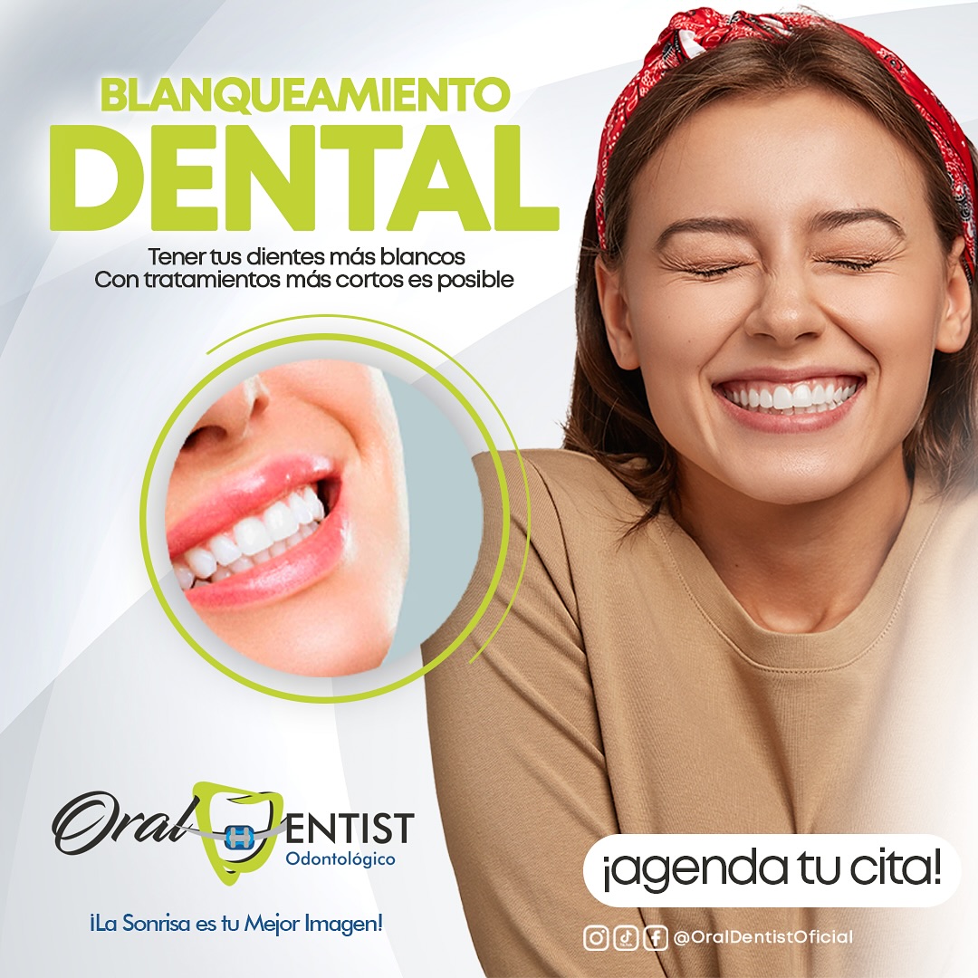 Resultado real de blanqueamiento dental — Oral Dentist
